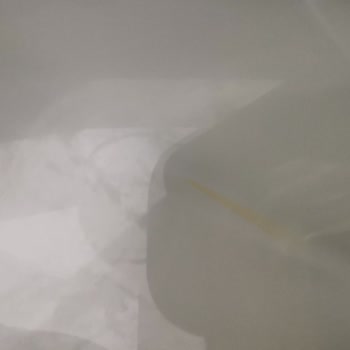 Siemens Buzdolabında Garanti Sorunu ve İç Sararma