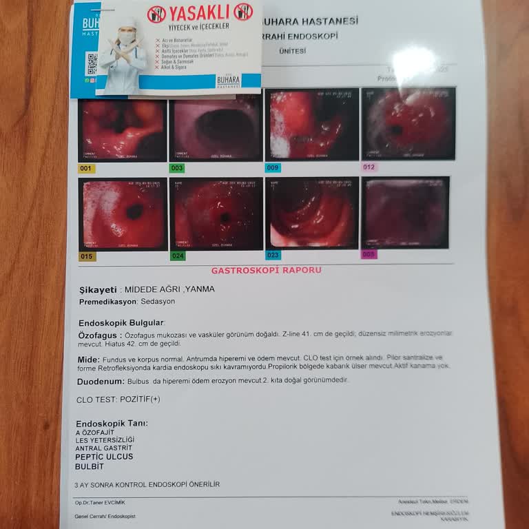 Zorunlu Endoskopi Reddine Karşı Umutsuz Bekleyiş