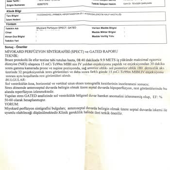 Vivense Teslimat Sorunu: Beklenen Koltuklar Gelmedi