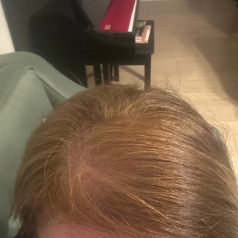 Keratin Düzleştirici Sonrası Saç Renk Değişimi Ve Koku Sorunu