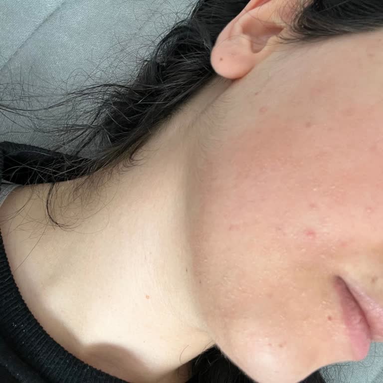 Solante Krem Hayal Kırıklığı: Trendyol'da Sorun Çözülmüyor