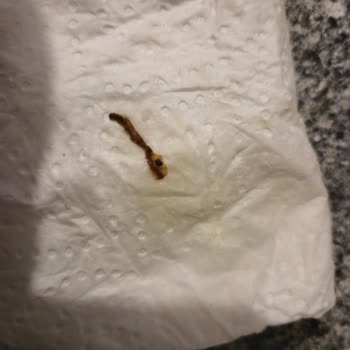 Milupa Bebek Ürününde Tehlikeli Yabancı Madde Şoku!