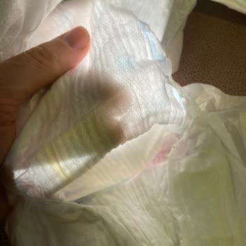 Molfix Premium Bebek Bezinde Eksik İç Malzeme Şoku