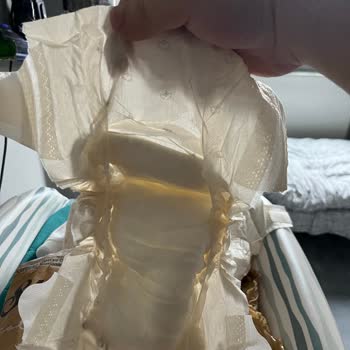 Bebek Bezlerinde Eşit Dağılım Sorunu