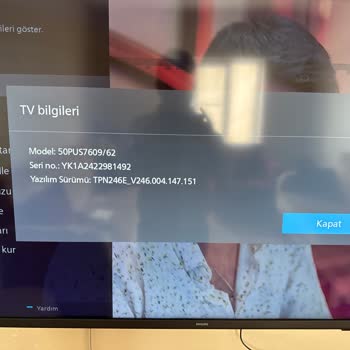 Philips TV'de Beklenmedik Ekran Sorunu Ve Değişim Talebi