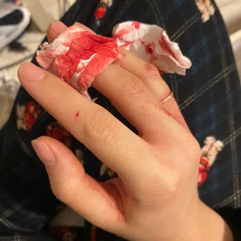 Özensiz Üretim: Niacinamide Serum Kazası