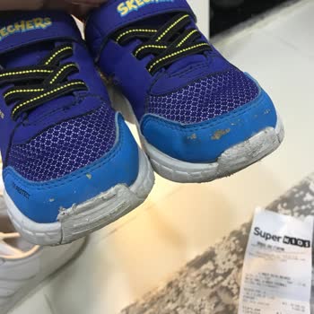 Skechers Ayakkabının Hızla Deforme Olması
