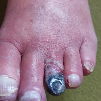 Mehmet Akif Ersoy Devlet Hastanesi Yaşlı Hastaya Saygısız Ve Yetersiz Hizmet!