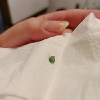 Makbul Lokumları: Sağlık Tehlikesi Ve Müşteri Hizmetlerinde Hayal Kırıklığı