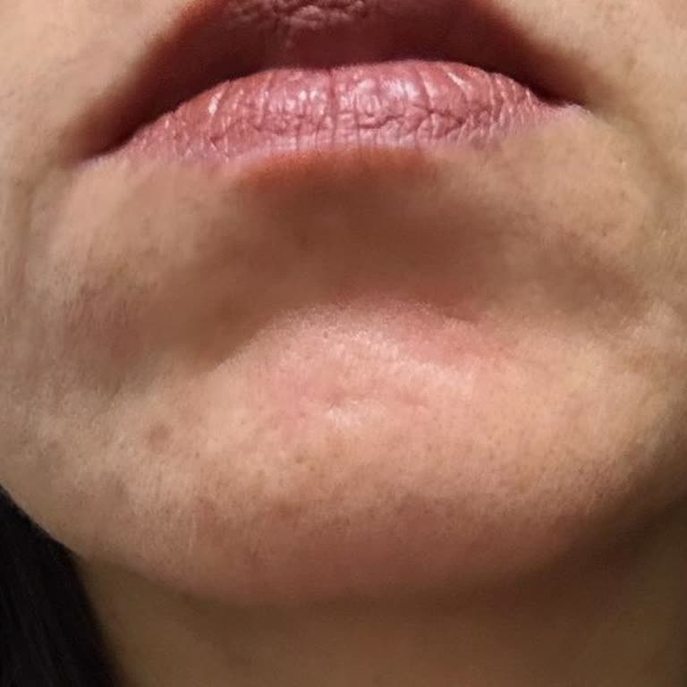 Bioderma Serum Cildimde Sorun Yarattı