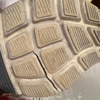 Skechers Ayakkabının Hayal Kırıklığı Yaratan Kalitesi