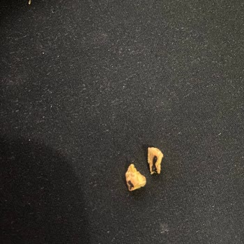 Zirve Soğuk Baklava Fıstıklı Baklavanın İçinden Yabancı Cisim Çıktı