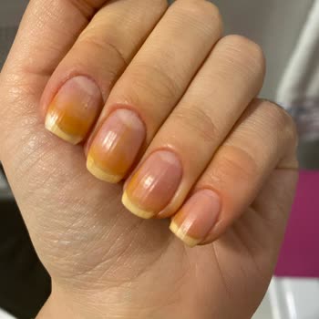 Flormar Oje Tırnaklarda Kalıcı Lekeler Bırakıyor