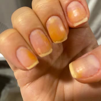 Flormar Oje Tırnaklarda Kalıcı Lekeler Bırakıyor