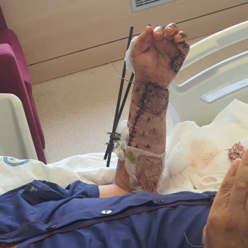 Otobüs Kazasında Yaşanan Felaket Ve İlgisiz Firma Tavrı
