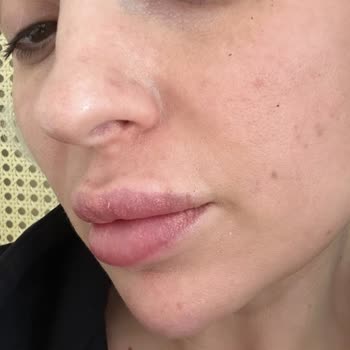 Lavinya Güzellik Merkezi'nde Hayal Kırıklığı: Sonuçsuz Dudak Renklendirme