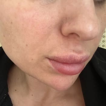 Lavinya Güzellik Merkezi'nde Hayal Kırıklığı: Sonuçsuz Dudak Renklendirme