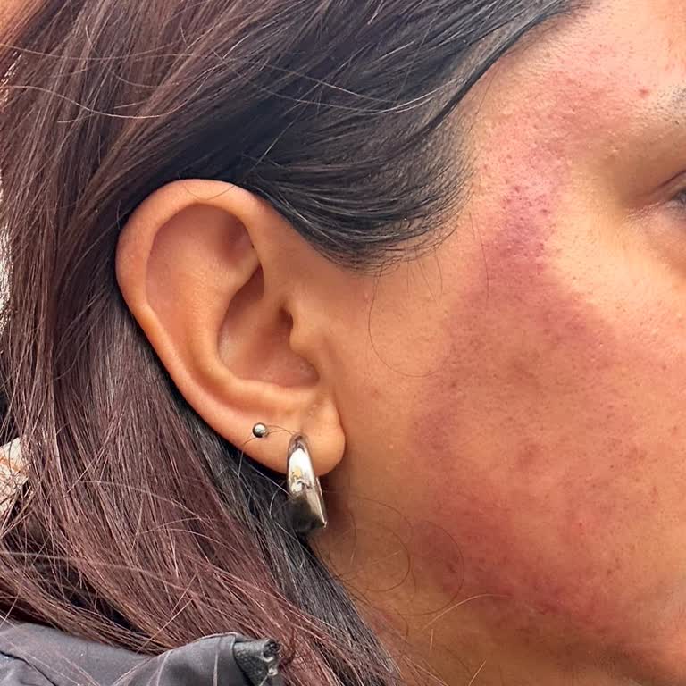 Gecikmeli Ve Dikkatsiz Hizmet Deneyimi