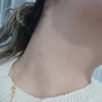 Trendyol'dan Aldığım Ürün Alerji Ve Yan Etkiler Yarattı