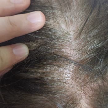 Koleston Saç Boyası Beklentileri Karşılamadı