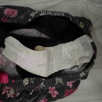 Güvenilirlik Sorunu: Pedlerin Sürekli Çıkmaması