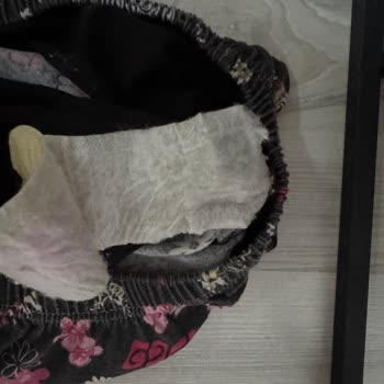 Güvenilirlik Sorunu: Pedlerin Sürekli Çıkmaması