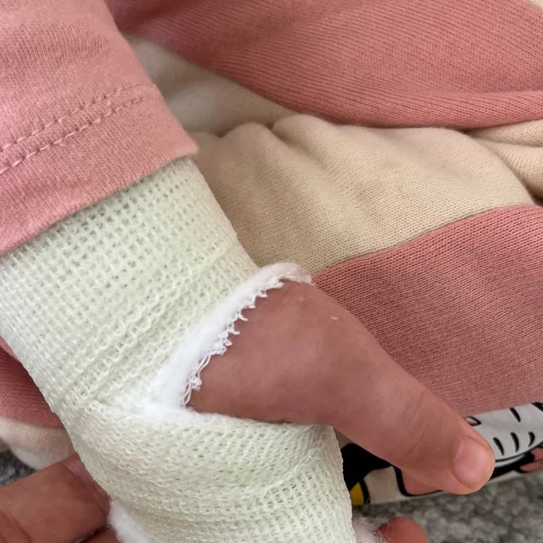 Hızlı Kaydırak Kızımın Kolunu Kırdı, İlgisizlik İçimizi Acıttı