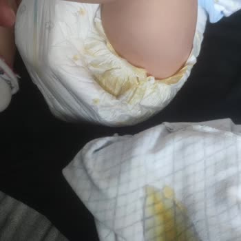 Sleepy Bebek Bezlerinin Kalite Sorunu: Hayal Kırıklığı Ve Sızdırmazlık Problemi