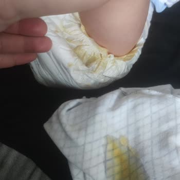 Sleepy Bebek Bezlerinin Kalite Sorunu: Hayal Kırıklığı Ve Sızdırmazlık Problemi