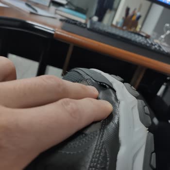 Skechers Ayakkabımın Yanı Açıldı Hakkım Yeniyor