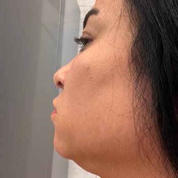 Dr. Sevil Klinik (Nişantaşı) Gıdı Operasyonu Sonrası Memnuniyetsizlik!