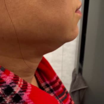 Dr. Sevil Klinik (Nişantaşı) Gıdı Operasyonu Sonrası Memnuniyetsizlik!