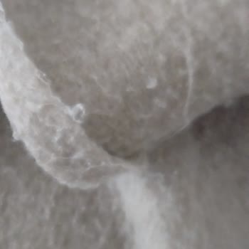 Bershka'dan Aldığım Atkı Hızla Tüyleniyor Ve İade Talebime Yanıt Yok