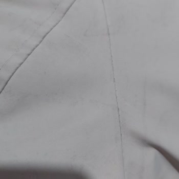 Mavi Montta Kalıcı Lekeler Ve İlgisizlik