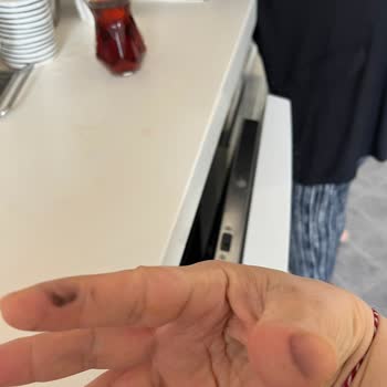 Kontrol Edilmeden Satışa Sunulan Ürün Tehlike Saçıyor