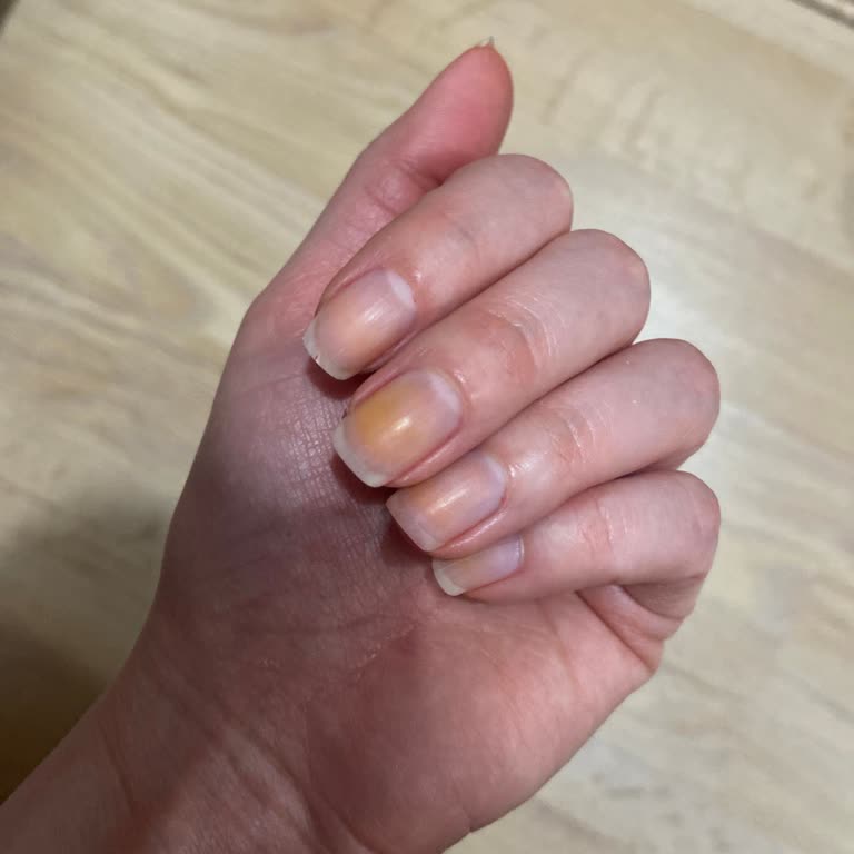 Flormar Oje Sonrası Tırnak Sararması Şoku