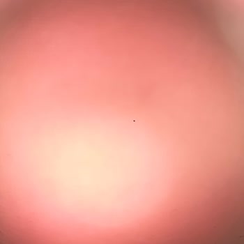 Enpara'da Para Çekme Engeli Ve Hukuki Süreç Tehdidi