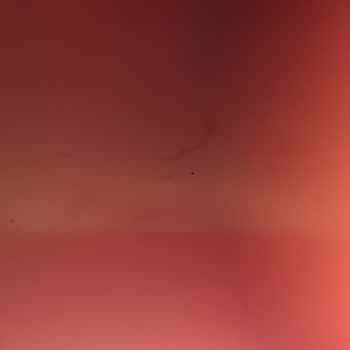 Enpara'da Para Çekme Engeli Ve Hukuki Süreç Tehdidi