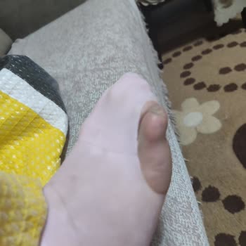 Silikon Çoraplar İlk Giyimde Parçalandı