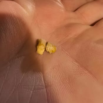 İmam Çağdaş'ta Lezzet Ve Hijyen Hayal Kırıklığı