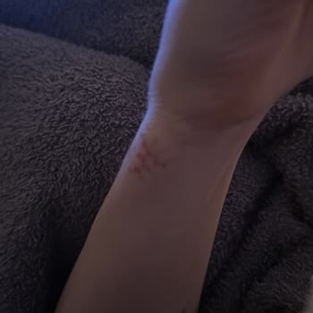 Dyson Airwrap Kullanımı Sonrası Yaşadığım Talihsizlik