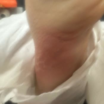 Dyson Airwrap Kullanımı Sonrası Yaşadığım Talihsizlik