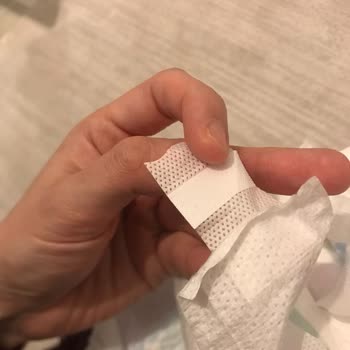 Ebebek'ten Alınan Molfix Bezde Hatalı Cırt Sorunu