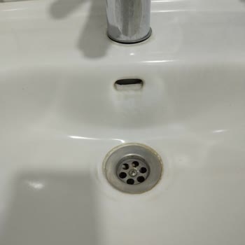 Versa Hastanesi Yenilik Bekleyen Hastane Deneyimi