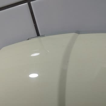 Versa Hastanesi Yenilik Bekleyen Hastane Deneyimi