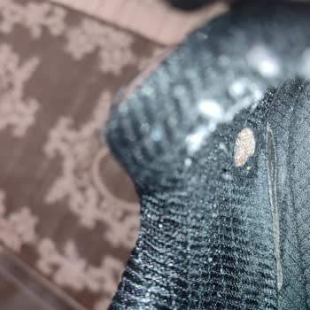 Sketchers Ayakkabıda Üretim Hatası Ve Müşteri Hizmetleri Sorunu