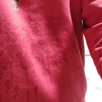 Patlayan Tonik Ve Yetersiz Müşteri Hizmeti