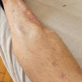 Sigorta Şirketinin Yetersiz Hizmeti Ve Mağduriyet