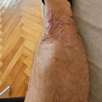 Sigorta Şirketinin Yetersiz Hizmeti Ve Mağduriyet