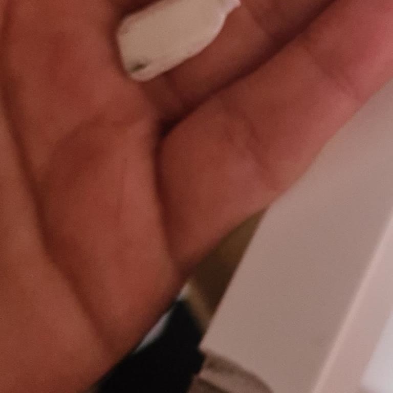 Kırık Çerçeve Ve Yetersiz Müşteri Hizmeti